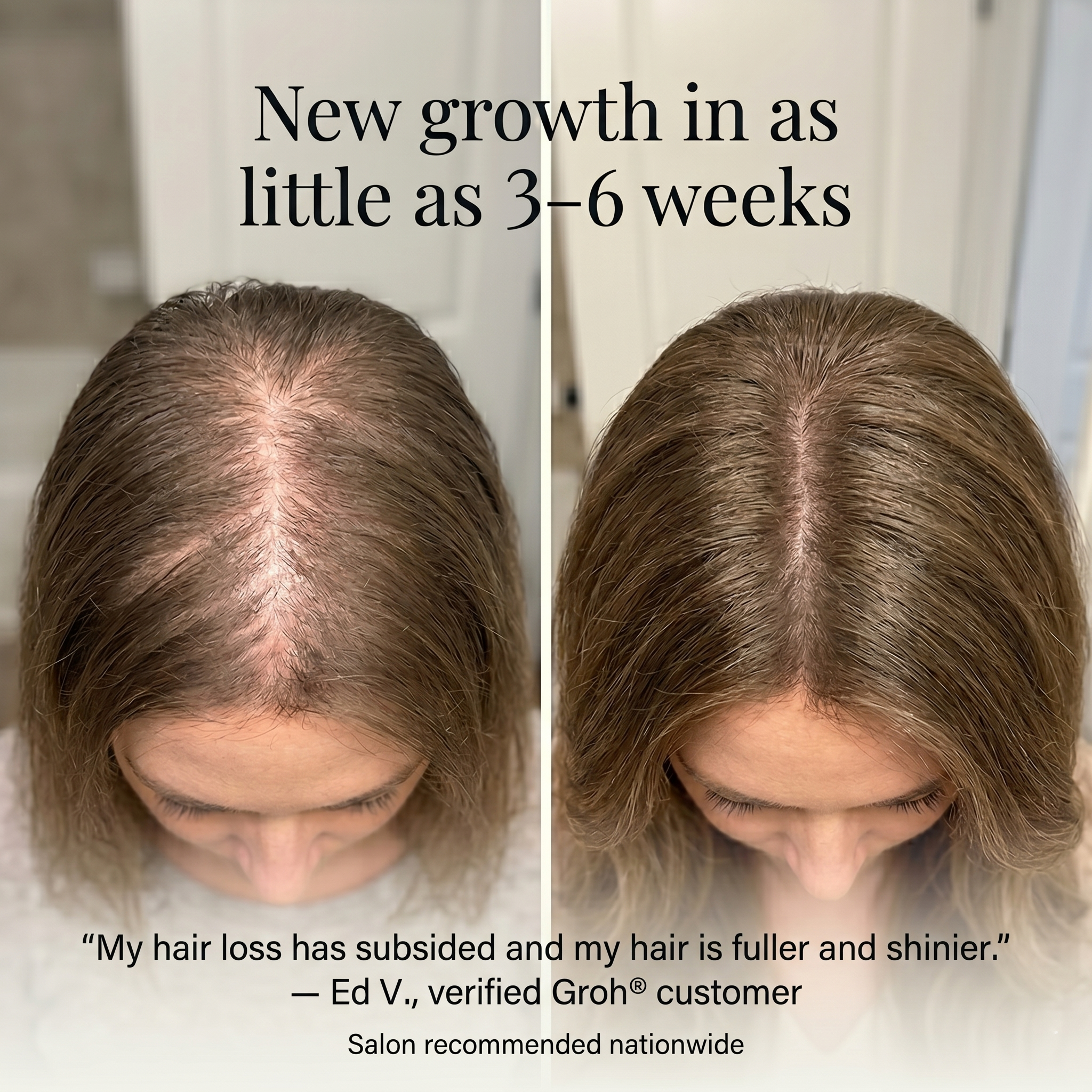 Thinning Hair and Hair Loss | Groh® Hair Regrowth Products